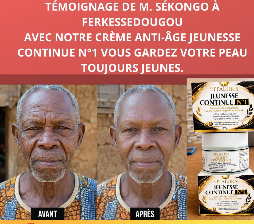 ADIEU AUX RIDES ET AUX VISAGES FROISSÉS ! RETROUVEZ L'APPARENCE D'UN VISAGE DE 45 ANS, MÊME À 80 ANS, AVEC JEUNESSE CONTINUE N°1.