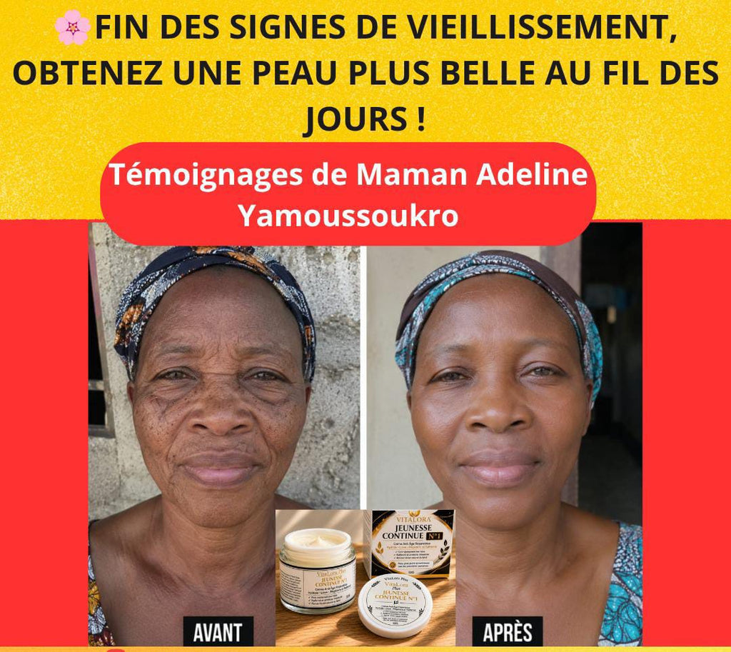 ADIEU AUX RIDES ET AUX VISAGES FROISSÉS ! RETROUVEZ L'APPARENCE D'UN VISAGE DE 45 ANS, MÊME À 80 ANS, AVEC JEUNESSE CONTINUE N°1.